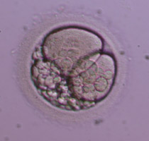 2-cell Grade III